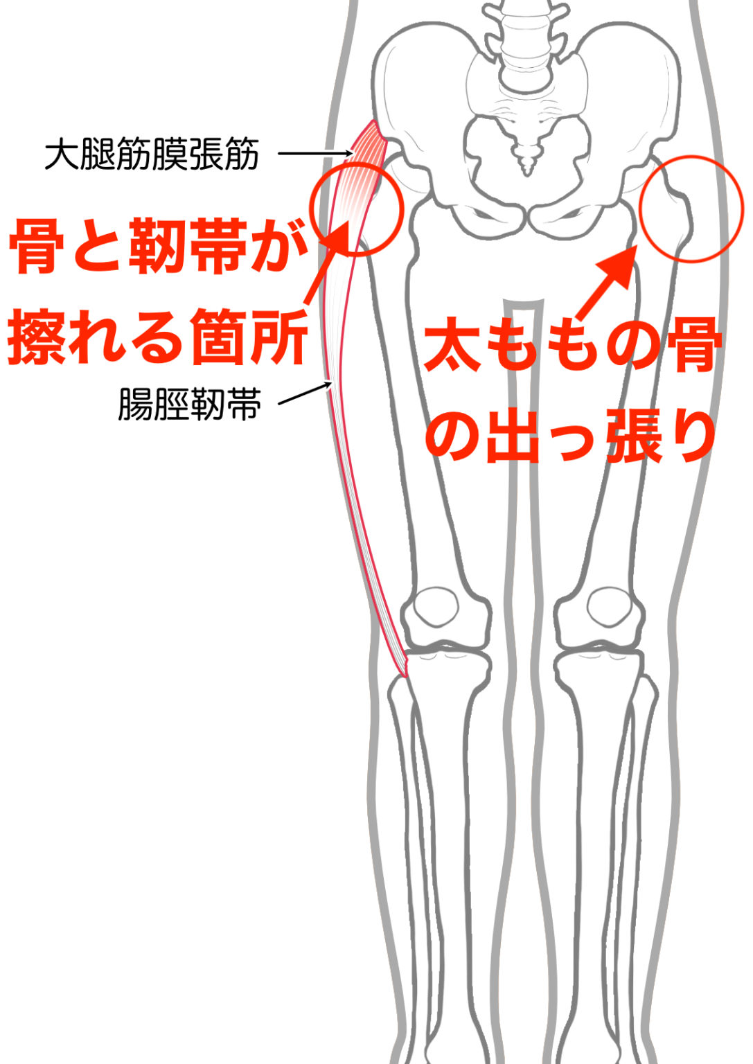 “股関節を動かすと内側から音が鳴るし痛い” その症状「弾発股」かも? | 加古川市新神野 ひさき鍼灸整骨院